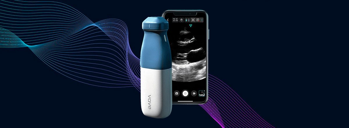Pocket Doctor. Ultrasound Device That Connects to a Smartphone